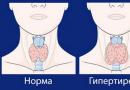 Заболевание щитовидной железы у женщин: симптомы и причины болезни