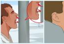 Apa yang harus dilakukan jika lidah anak membeku karena setrika: algoritma perawatan darurat