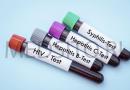 Kako se pripraviti na teste za hepatitis?